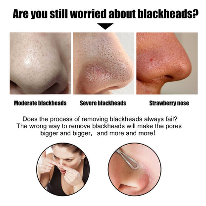 Bamboo Charcoal Blackhead Removing Strip