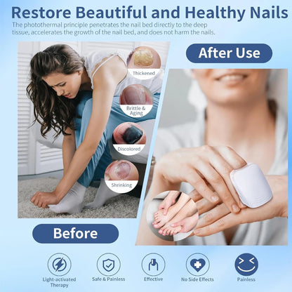 Nail Fungus Laser Treatment Device Repair Toenail Fingernail Fungus Treat Onychomycosis Laser Nails with Mushrooms Relaxation