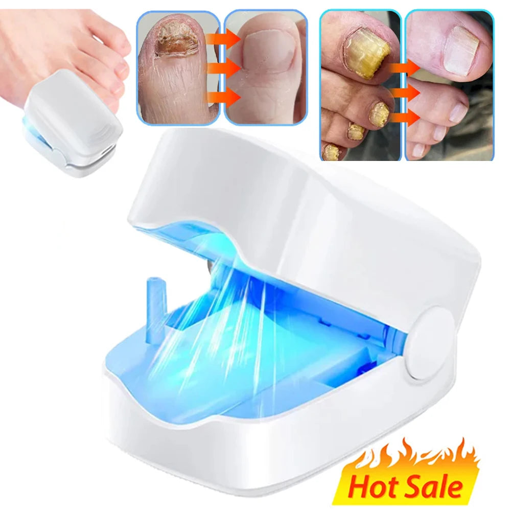 Nail Fungus Laser Treatment Device Repair Toenail Fingernail Fungus Treat Onychomycosis Laser Nails with Mushrooms Relaxation